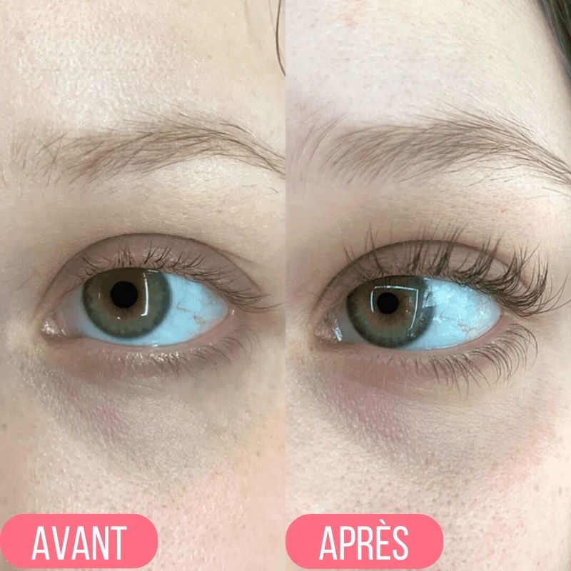 Avant / Après Elaya