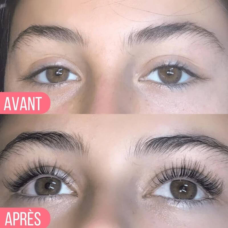 Avant / Après Elaya
