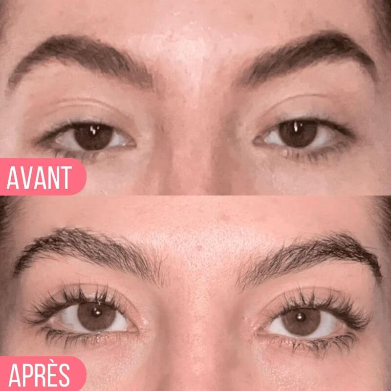 Avant / Après Elaya