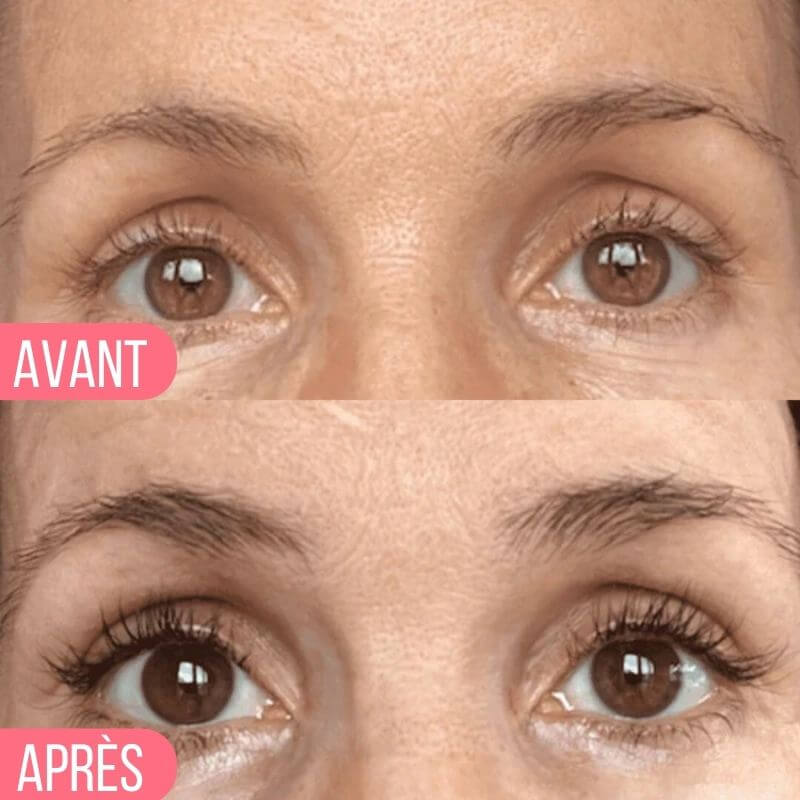 Avant / Après Elaya