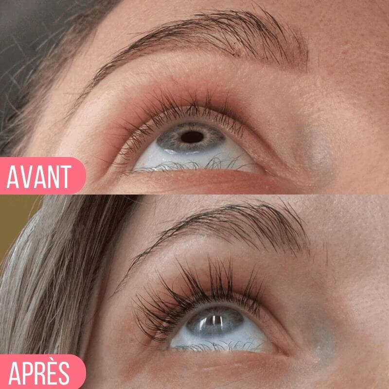 Avant / Après Elaya